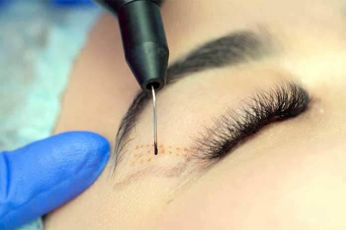 Eyelid-Surgery-More-Than-A-Fresh-Look