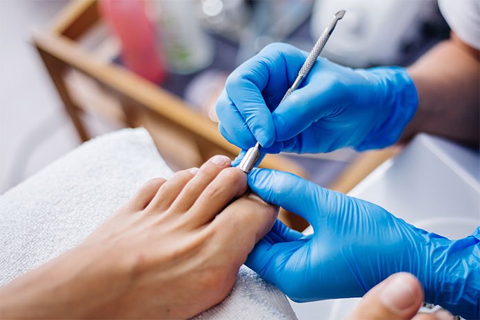 Mycosis On The Toenail And Bleach Does It Work